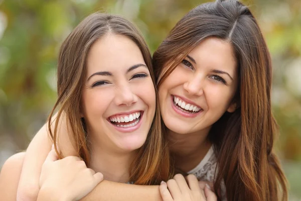 Две женщины друзья смеялись с идеально белые зубы — стоковое фото